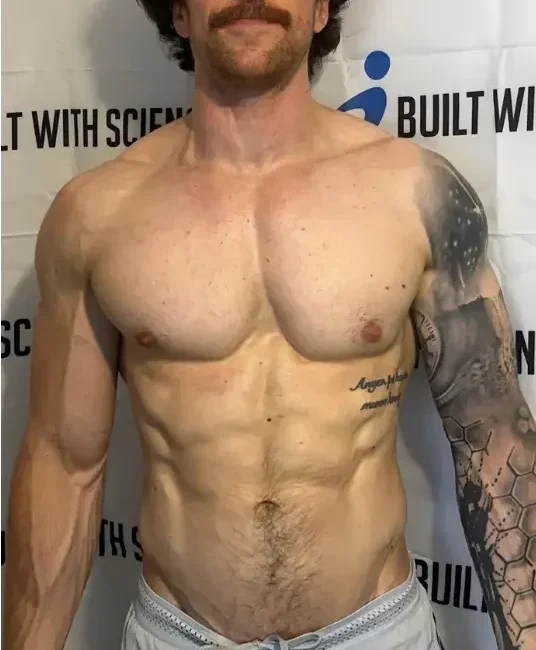 Dylan-Ryan-before_after-1