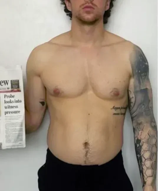 Dylan-Ryan-before_after-1